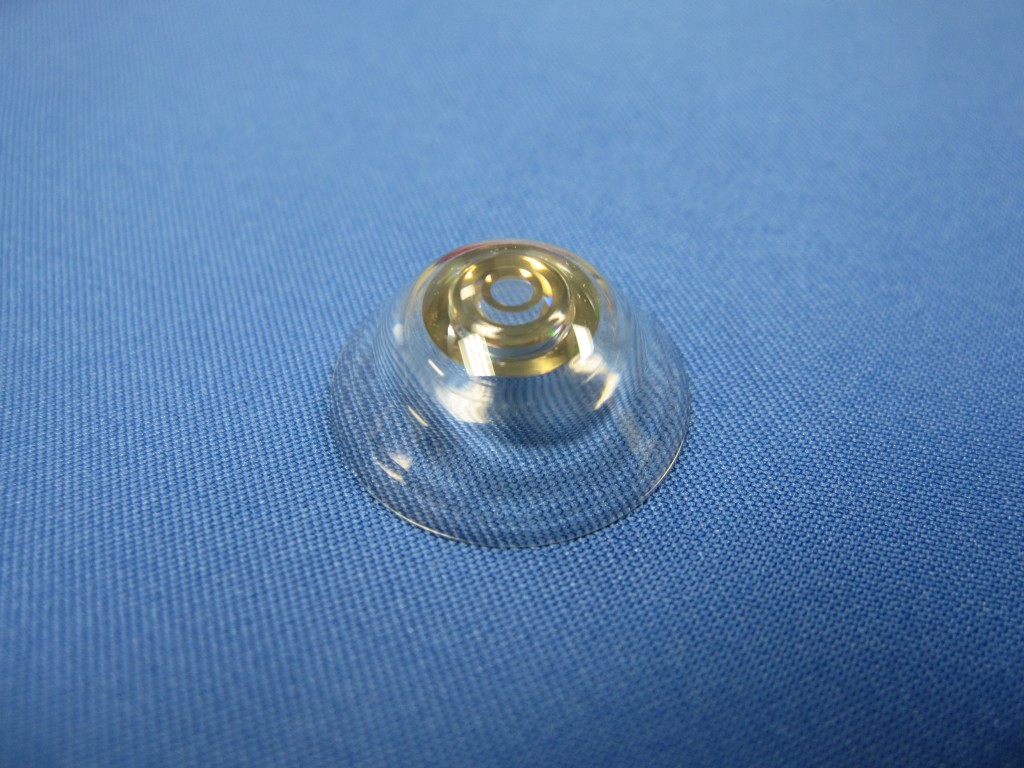 contact lens